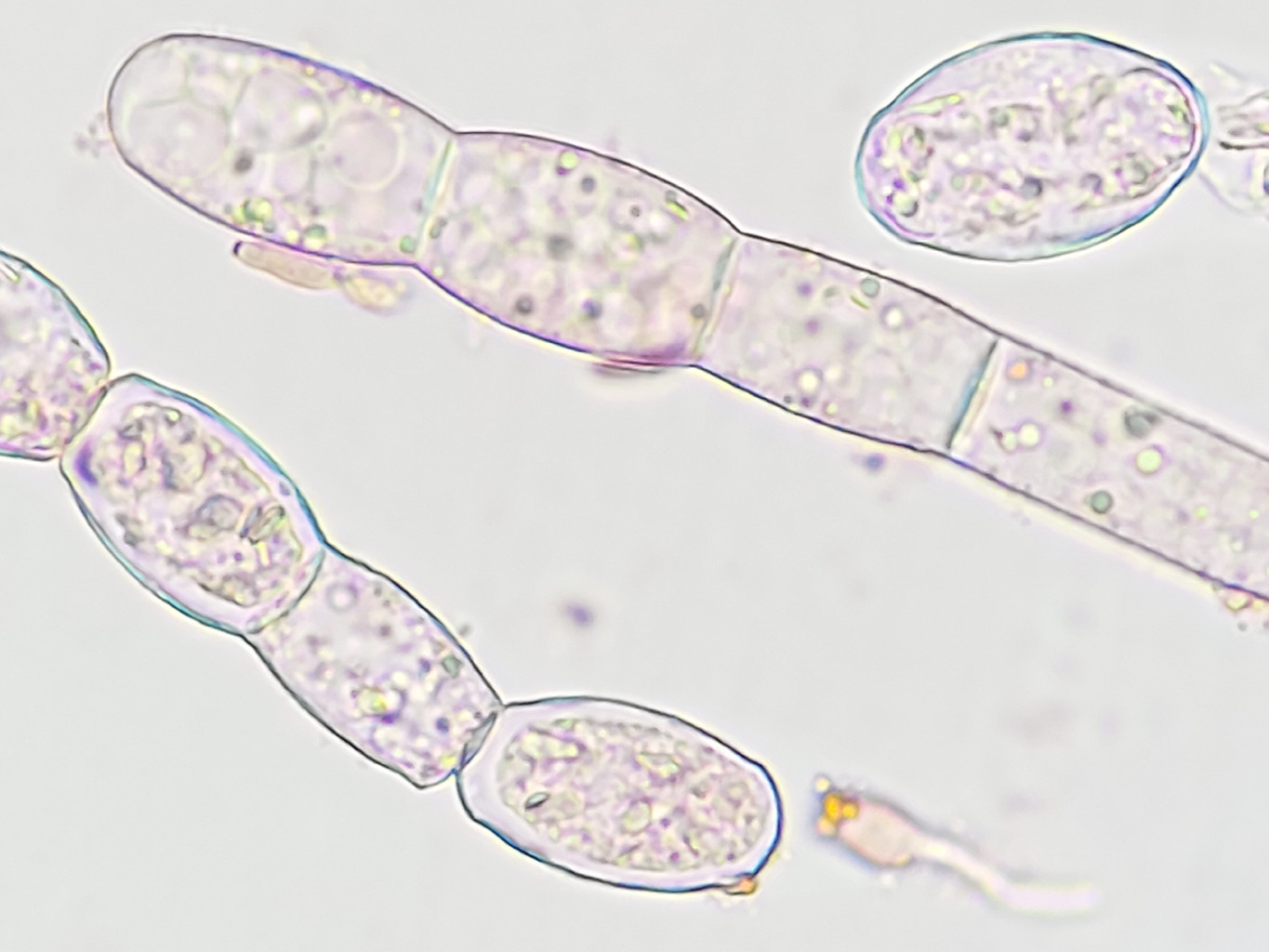 meeldauw onder de microscoop