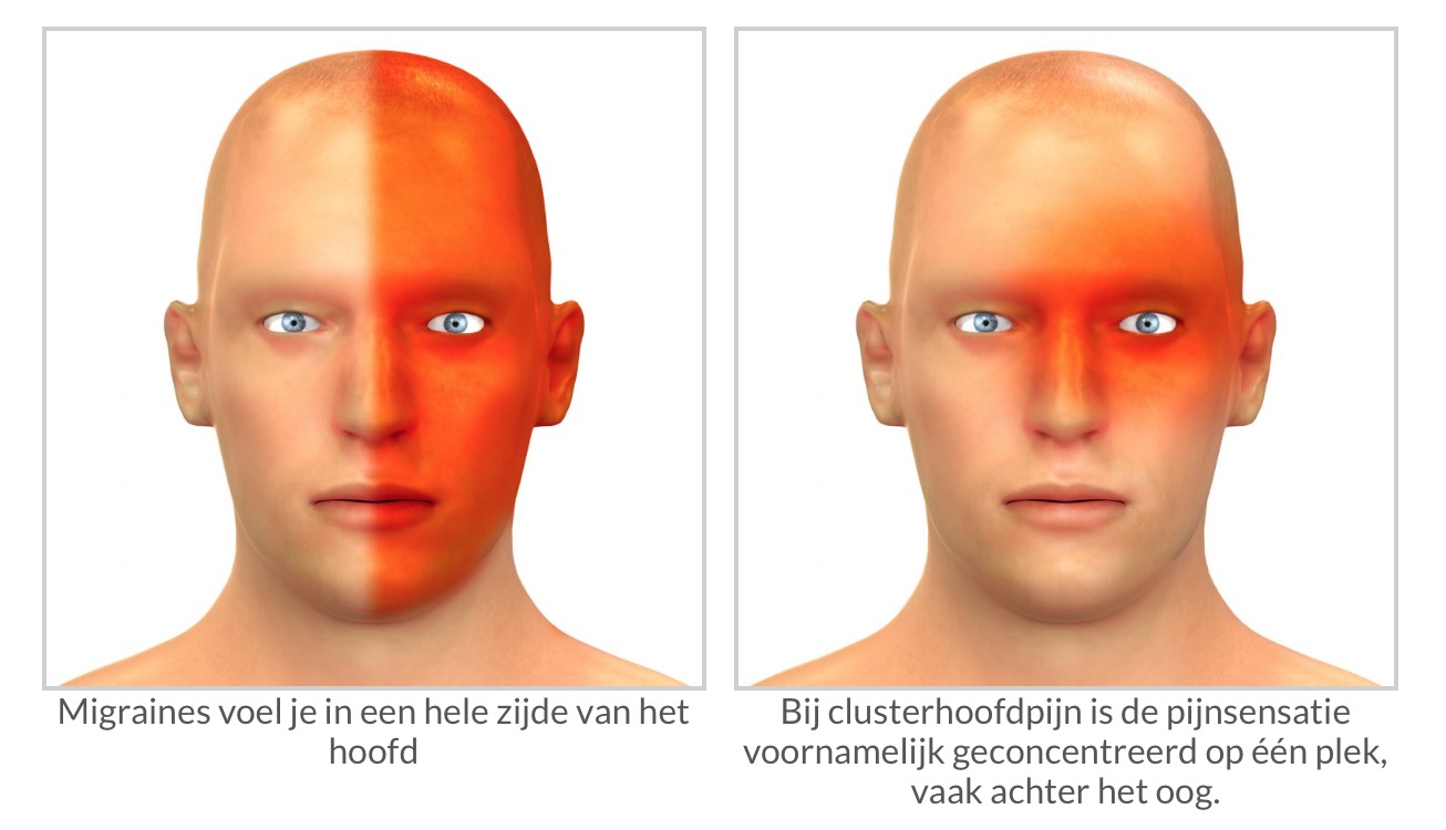 Wiet effectiever tegen migraine dan reguliere medicatie CNNBS.nl Wiet effectiever tegen migraine dan reguliere medicatie CNNBS.nl