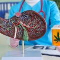 Flink aan de wiet? Lager risico op leveraandoening door alcohol!